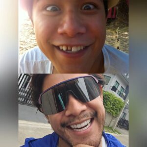 Ratchanont Suprakob Instagram - พอฟันสวยแล้วก็กลับไปดูรูปเก่าๆ....แล้วมาเจอรูปนี้ 😂  @proudsmiledentalclinic @drkanlapat