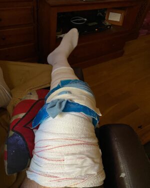 Roberto García Ruiz Instagram - Pues toca ponerse las pilas y recuperar. Animado y decidido a darlo todo para una pronta recuperación….Una más a la lista. 🤗🤗🙏🙏