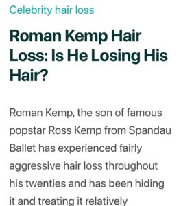Actor Roman Kemp HD Instagram Photos and Wallpapers July 2024