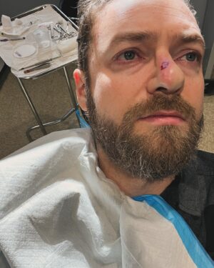 Ross Marquand Instagram - Well folks, I finally decided to listen- to family, friends, and fans. Countless people told me to get my nose checked over the past four years and I always said I was too busy and couldn't possibly find the time...which was partially true. My schedule has been absolutely bonkers for longer than I can remember. But guess what? I let this problem fester and it grew into cancer...and left unchecked it could've become much, much worse. 
I hesitate to share this because I'm usually a very private person but I'm posting this to encourage all of you to prioritize your health - be that physical, mental, or emotional. I clearly did not, and now I'm playing catch up. Hopefully I'll have many more days to learn and grow- to be healthier, to be better...but nothing in this life is certain. 
Get yourself sorted and please don't wait like I did. Lots of love to everyone for their kind words of support and encouragement, happy holidays, and oh yeah... #fuckcancer 🏥