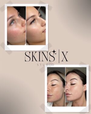 Roxanne St-Onge Instagram - MEGA GIVEAWAY DES FÊTES🎁✨

GAGNE UNE TRANSFORMATION BEAUTÉ POUR TOI ET TON/TA BESTIE. 🤶🏼🎄✨

@skinsxstudio @brows.by.sb et @heatherxtensions vous donne la chance de gagner un prix d’une valeur de plus de 1 000$ pour toi et ton/ta meilleure amie !!!!!

PRIX À GAGNER:

-2 traitements au laser IPL
-2 laminations des sourcils
-2 poses de cils 

POUR PARTICIPER:

1. Abonne-toi aux comptes qui suivent 

- @brows.by.sb 
- @heatherxtensions 
- @skinsxstudio 
- @ambitiousmedia.ca 

2. Identifie les personnes qui mériteraient de gagner 
(1 commentaire = 1 chance) 

3.Partage la photo dans ta story en identifiant tous les comptes 

BONNE CHANCE À TOUS !!!! 

Le tirage aura lieu le 6 janvier.