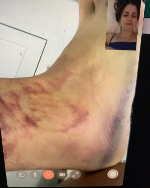 Ruairí O'Connor Instagram - ANKLE 2021