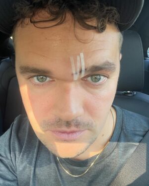 Ruben Søltoft Instagram - altid drømt om et frækt ar