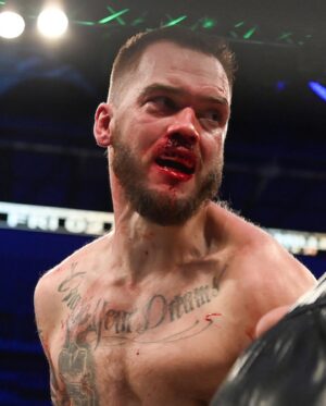 Ryan Taylor Instagram - YA KNOW WE GOTTA RUN THIS ONE AGAIN! ASAP! @misfitsboxing @daznboxing @sauerlandbros @mamstaylor 

What an incredible challenge lastnight was. If I listened to my corner JUST a little bit more I wouldn’t have walked into the punch that changed the whole night for me. From that right hand that hit my nose I couldn’t breath there was so much blood coming through that’s why I had to spit it at everyone 🤣🤣🤦🏼‍♂️🤦🏼‍♂️ BUT YOOOO!!!! What a fucking night. Big love to everyone who came and supported. Big love to my team! My COACH @joshuaridgwell love you kid you have the brightest future ahead of you. My Other coach and big brother @kanem14 the Danger!!!!! Couldn’t have done this without you g. @connortierneybkfc my brum brudda who loves to fight without gloves and next camp is going to be a much bigger part of. My S&C @kk_dubai and the whole of the gang at @strongcombat_hq @ramzi_yahia @mounirlazzez @john_boimma @younes_rabah_ my brothers for life. I just started fighting this year and Clearly ring experience shows in my Opponents performance. I WANNA GO AGAIN! NOWW!! Fair play to slimmy tits for getting the win but I know he’s not gonna get me out his head after punching me with all he’s got and I just kept walking him down 🤦🏼‍♂️🤣 WHAT A NIGHT. Thank you boxing this is definitely my new sport I love it. Now back to the drawing board 😈🤩🤩 #boxing #ryantaylor #everythingcerti #slimstillabitch 😉