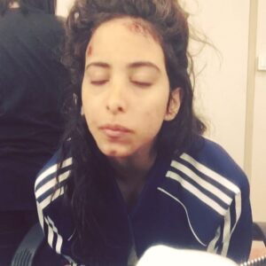 Samar Qupty Instagram - Now on @yestv📺 

Make Up by the amazing:
@_kerenasaf 
revital_cohen_makeup 

#tvseries #shooting #makeup #set #onair #yes #tv #newtvseries #samarqupty #drama #makeupartist #act #actorslife #actresses #arabactress @yesstudios @zionrubin33 @taagad