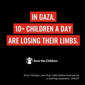 Sammy Sheik Instagram - Since 7 October, more than 1,000 children in Gaza have had one or both legs amputated. Many of these operations on children were done without anaesthetic. #CeaseFireNow