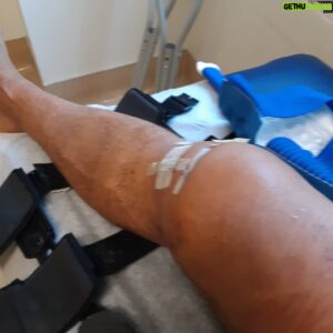 Sean Waltman Instagram - Today was my 1st appointment 6 days after surgery. Still swollen. The pain has been tolerable. I only used 1/2 /the pain medication I was prescribed. Anyways, just wanted to check in. Thank you to everyone who reached out. Means a lot to me.🙏