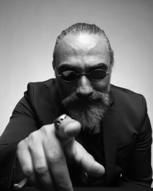 Selim Bayraktar Instagram - Evet o iki damar...Supratroklear arter, üst göz kapağını, periosteumu(kemiğin enlemesine büyümesini sağlayan zar) ve ayrıca alın kaslarını ve bitişikteki cildi besler sayın @amuratarik