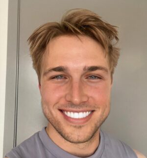 Shayne Topp Instagram - Had a great dentist appointment!