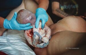 Sherry A. Ross Instagram - An amazing en caul birth photo! An en caul birth is a rare event where the baby is born inside the intact amniotic sac. #fotofriday 

📸: @jessica_vi_photography