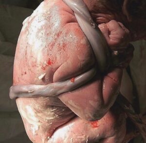 Sherry A. Ross Instagram - The umbilical cord is on average 24 inches long. It is the lifeline between the baby and the placenta. This magical cord delivers oxygen and nutrients to a growing and developing baby during the nine month journey of pregnancy.
#FotoFriday

📸: @softcornermidwitery