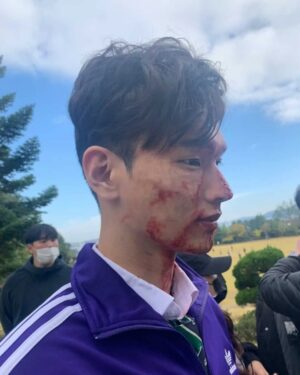 Shin Jae-hwi Instagram - 반대편 사진은 나도 징그러워서 못 보겠다 

#nexflix #지금우리학교는 #창훈 #allofusaredead