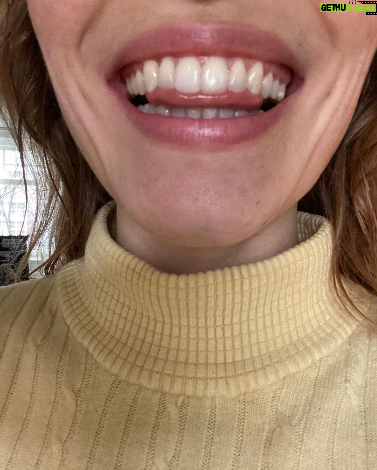 Sigrid ten Napel - 1.4K Likes - Het was een BEWOGEN jaar ook voor mān tandjes. :)))
30
Heel veel zin om de hele dag Billie Eilish lyrics te quoten in mān msn naam.
š