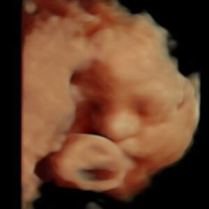 Sigurbjörg Alma Ingólfsdóttir Instagram - May ✨🌸 swipe to the end for a sneak peak of the boy in my belly 🥰