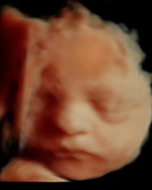 Sigurbjörg Alma Ingólfsdóttir Instagram - May ✨🌸 swipe to the end for a sneak peak of the boy in my belly 🥰