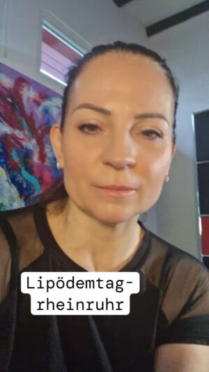 Silke Kayedelen Instagram - @lipoedemtagrheinmain #lipödem #lipödemcommunity #lipödemfighterin #lipödemisteinarschloch