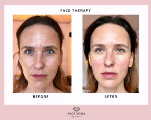 Simona Rýdlová Instagram - Face Therapy ✨💆🏻‍♀️
- je moje originální technika
- není to masáž, je to cvičení
- vy nic dělat nemusíte 
- hodinová, hluboká technika
- pracuje se se svaly a lymfou
- kombinace několik technik, kde se svaly nejdřív uvolní a pak vytvoří nový svalový návyk
- po hodině je viditelný Face lift efekt
- je to jako bootcamp, masáž a psychoterapie zároveň
- velký pocit uvolnění potom
- uvolněná čelist a šíje
- pevnější kontury
- rozzářená pleť
- klientky chodí po cca měsíci, obličej pak drží
- foceno na stejném místě pod stejným světlem po hodině Face Therapy, pleť prostě září a odráží světlo jinak
- v prvním Face Yogovém studiu u nás, Bělehradská 35
P.S.: říkám tomu obličejový orgasmus, nedá se to moc vysvětlit, dokud to nezkusíte 🥰
.
#faceyogasimona #faceyoga #facetherapy #prirozenapece #naturalcare #naturalbeauty #rocks #jdetoprirozene #nobotox