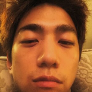 Sung Joon Instagram - 다래끼 vs 물놀이 돼지고기(저녁엔 술마실예정) 덤벼라 다랚e