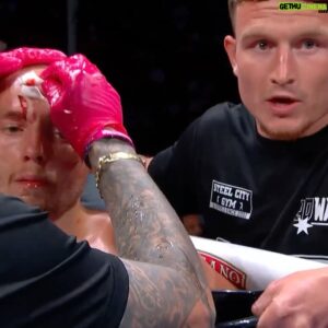 Sunny Edwards Instagram - Head clash causes an AWFUL cut for @sunnyedwards 🤯🩸 #EdwardsCuriel #FightNight #EstradaBam