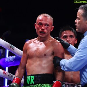 Sunny Edwards Instagram - battered, beaten & bruised.

never broken.

@daznboxing @matchroomboxing