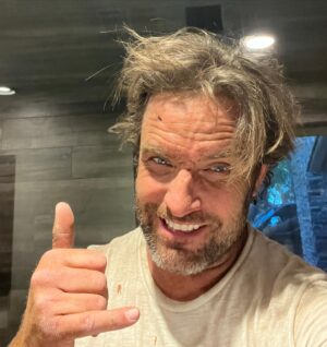 T.J. Lavin Instagram - Day one of palm skinning in the books.. this stuff is hard AF. Only about 100 more or so to go.. no worries haha😂🤙