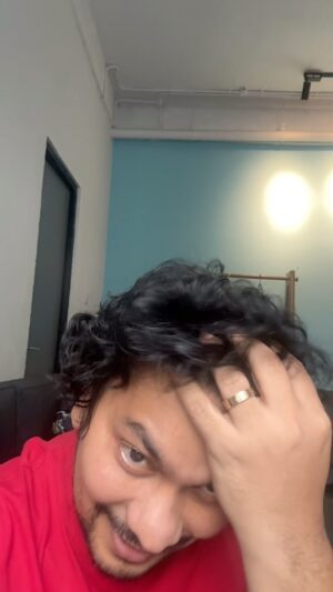 Tompi Instagram - VIRAL: ternyata rambut bs doain dan tumbuh. Tapi ditanam dulu di @beyoutifulhairtransplantcenter . 

Udah sering denger cerita tanam rambut katanya SAKIT, Nah di beyoutiful DIJAMIN GAK PAKE SAKIT

Utk konsul ama sy bs ke BEYOUTIFUL T-SPACE BINTARO9  telp 0811 8111 0558  0811 8111 0559  BEYOUTIFUL PAKUBUWONO  jl PAKUBUWONO VI no 5a jaksel  62 821-1303-5099  0217211025