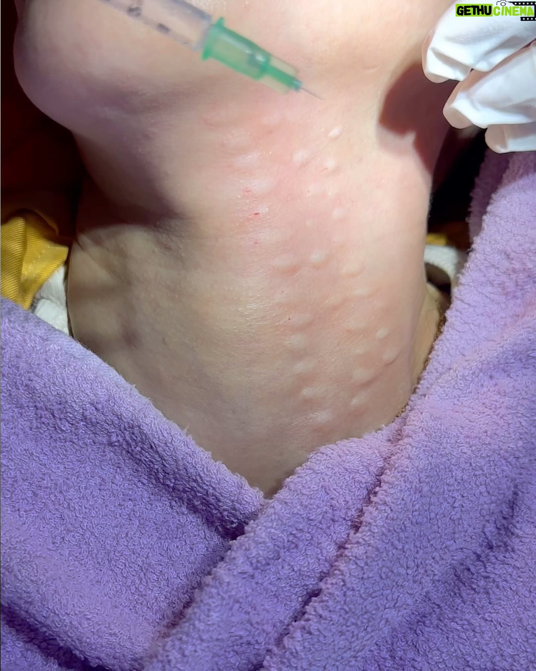 Tompi - 3K Likes - Leher keriput dan gelambir pasti GAK SEDAP! Nah di Beyoutiful ada treatment khusus utk masalah ini. Kerutan jd hilang, dan kulit jd lembab. Ini Bukan filler ya. Ada di semua cabang @beyoutifulbydrtompi