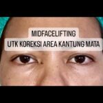 Tompi