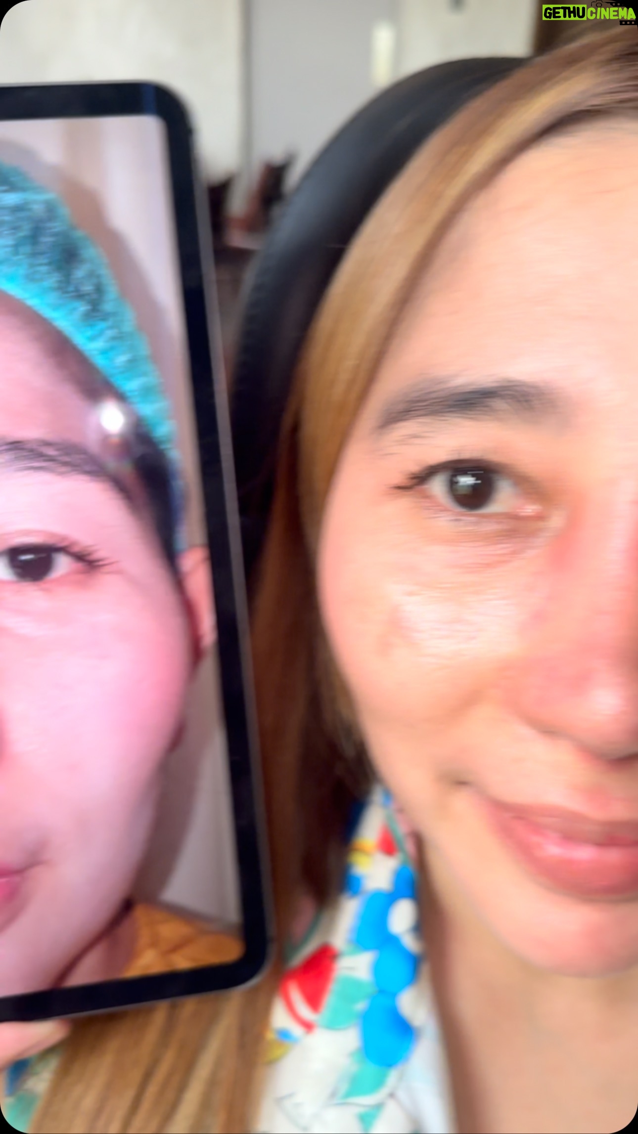 Tompi - 603 Likes - Hampir sebulan sejak op rhinoplasty iga