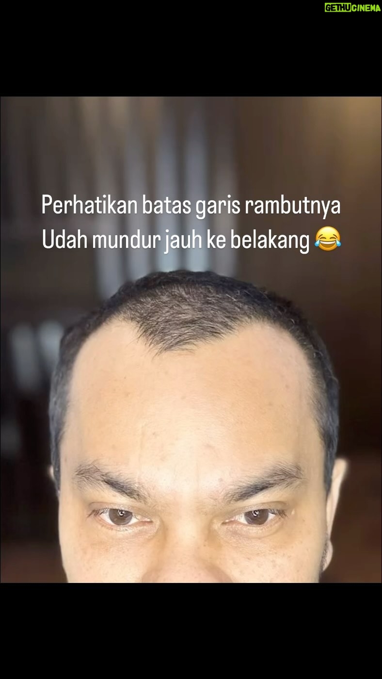 Tompi - 2.5K Likes - Gak berasa dah 10bulanan sejak tanam rambut di @beyoutifulhairtransplantcenter . GAK PAKE SAKIT sama sekali, dan bs padat rapat bgini. Pasca tindakan aktifitas normal ajaa kok. Nah utk detail mampir aja konsul.
BEYOUTIFUL T-SPACE BINTARO9
telp 0811 8111 0558 0811 8111 0559
BEYOUTIFUL PAKUBUWONO
jl PAKUBUWONO VI no 5a jaksel
62 821-1303-5099 0217211025