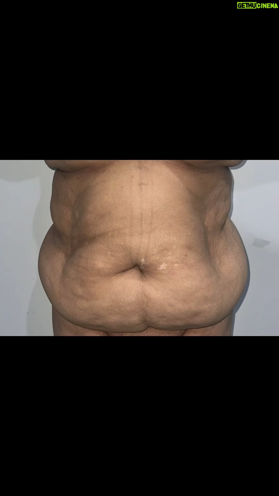 Tompi - 1.6K Likes - Emang bs sekecil apa sih abis tummytuck n liposuction?
Jangan lupa ada paket khusus selama JUNI 2024 utk tummytuck lipo body lengan paha dan breast augmentation
Nah SEMUA PERTANYAAN LANJUTAN KITA BAHAS SAAT KONSUL YA 😝
BEYOUTIFUL T-SPACE BINTARO9 telp 0811 8111 0558 0811 8111 0559 BEYOUTIFUL PAKUBUWONO jl PAKUBUWONO VI no 5a jaksel 62 821-1303-5099 0217211025