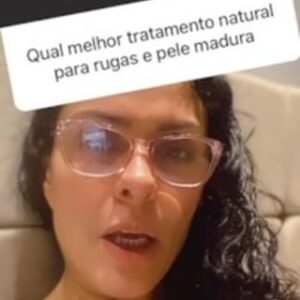 Vanessa Machado Instagram - Do story para o feed…
O Eight é mais do que um produto de skincare, é um aliado essencial para a pele madura. Com propriedades antioxidantes e anti-inflamatórias, o Eight é a escolha perfeita para cuidar da pele madura, proporcionando uma experiência sensorial única e resultados visíveis. Cuide da sua pele com o melhor, cuide com Eight. #pelemadura #skincare #Dermociencia #eight #cuidadoscomapele