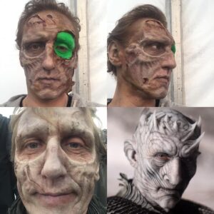 Vladimir "Furdo" Furdik Instagram - Thanks Barrie and Sarah and all your  prosthetic team 👍👍👍 @barriegower