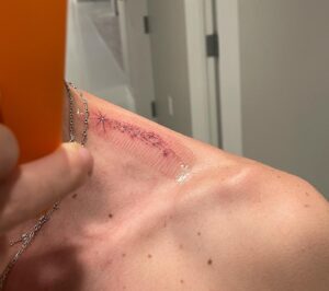 Will Peltz Instagram - Tattoo dump