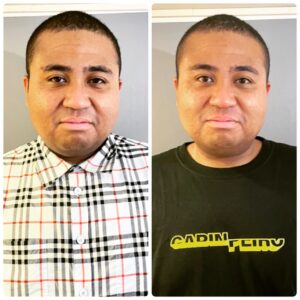 Anthony Instagram - ノリと思いつきで小顔サロンに行ったらホントに小顔になった！！！

#小顔サロン行ってみた
#マジ小顔になった
#顔のサイズより先に手をつけないといけない事はあるような気がします
#BERYLさんいきなりなのにYouTubeも撮影させてくれてありがとうございます