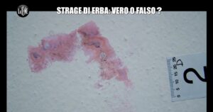 Antonino Monteleone Instagram - Il direttore di Gente, Umberto Brindani, chiede al generale Luciano Garofano (@lugarofano) se ricorda che fu proprio il RIS a riscontrare tracce di soggetti non conosciuti alle indagini.

Garofano risponde di no, aggiungendo il particolare delle tracce biologiche. 

Mi dispiace che il Generale, che stimo, abbia da recriminare sul servizio di ieri, ma…

Ma la traccia 2D oltre al sangue 🩸 contiene un “contatto papillare”, impronte digitali, mai attribuito.

Caro Generale @lugarofano non lo so se dietro la collina c’è la notte “crucca e assassina”, ma so che a marzo comincia la revisione. 
Perché gli assassini sono altri.

Con immutata stima

Antonino Monteleone

p.s.: il RIS di Parma, incaricato di cercare il profilo genetico di Rosa e Olindo sulla scena del crimine non ha trovato neppure una minima traccia.
In casa di Rosa e Olindo, il RIS di Parma, non ha trovato una sola traccia di alcuna delle vittime del massacro.