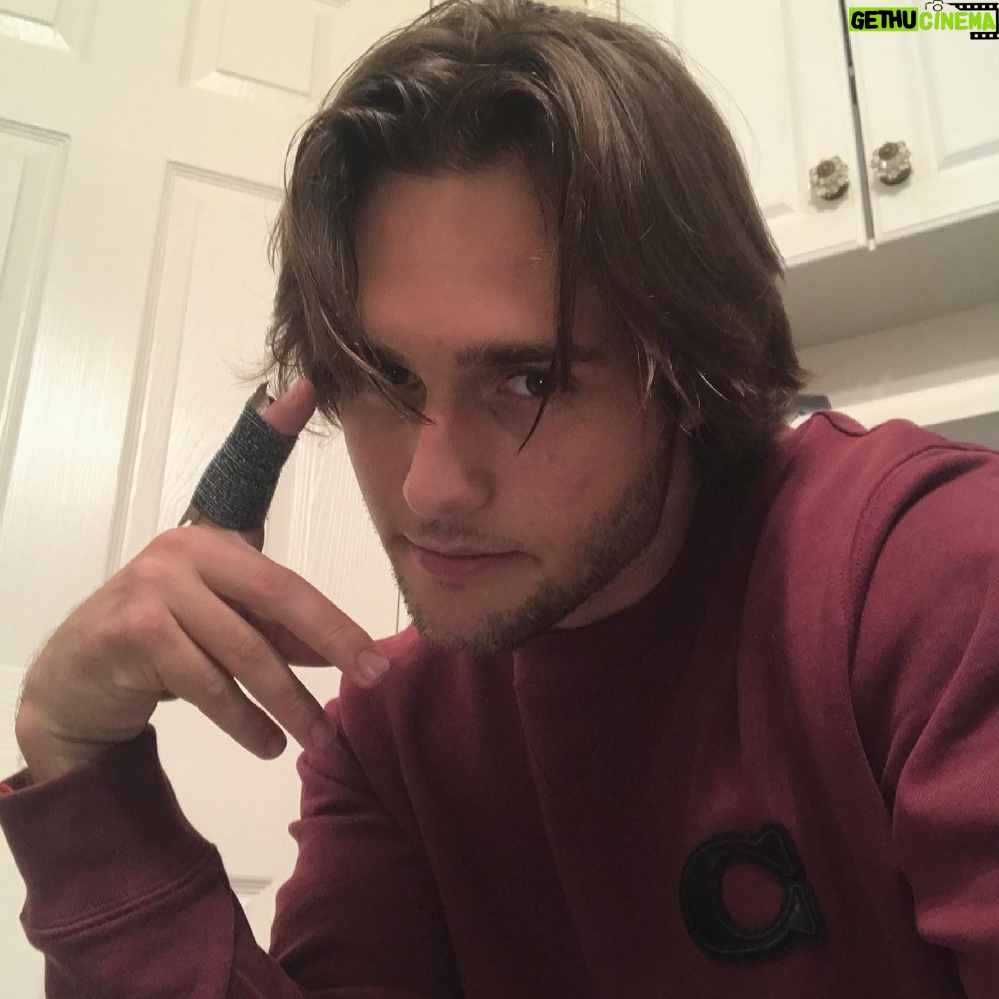 Cameron Moulène - 875 Likes - this finger never healed