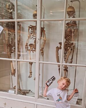 Carla Valentine Instagram - Who's in the same position? It's our 1st ever school summer holiday and for today only, after finishing Reception, I brought Caleb into work. He was incredibly keen to learn all about the skeletons while wearing his Bart Simpson "Bad to the Bone" t-shirt (he's been interested in skeletons and skulls since we went to the ossuary at St Leonard's Church in Hythe.) Hopefully other kids will be just as keen when we put an object handling event on, which I'm hoping to organise as committee member of @medicalmuseums this October ☠️ If you're interested in coming to our events over summer and in the autumn, email bartspathology@qmul.ac.uk to be placed on the mailing list.
For my OG followers, I know! Can you believe how much he's grown??! 
#pathology #pathologymuseum #medicalmuseum #medicine #anatomy #anatomymuseum #london #skeletons #wetspecimenconservation