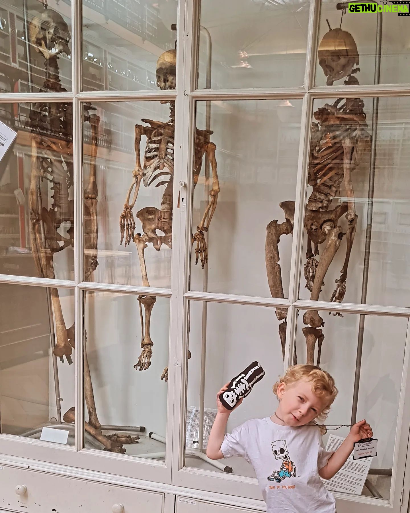 Carla Valentine - 410 Likes - Who's in the same position? It's our 1st ever school summer holiday and for today only, after finishing Reception, I brought Caleb into work. He was incredibly keen to learn all about the skeletons while wearing his Bart Simpson "Bad to the Bone" t-shirt (he's been interested in skeletons and skulls since we went to the ossuary at St Leonard's Church in Hythe.) Hopefully other kids will be just as keen when we put an object handling event on, which I'm hoping to organise as committee member of @medicalmuseums this October ☠️ If you're interested in coming to our events over summer and in the autumn, email bartspathology@qmul.ac.uk to be placed on the mailing list.
For my OG followers, I know! Can you believe how much he's grown??!
#pathology #pathologymuseum #medicalmuseum #medicine #anatomy #anatomymuseum #london #skeletons #wetspecimenconservation