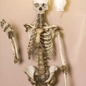 Carla Valentine Instagram - This is the skeleton of ‘The Yorkshire Witch’ Mary Bateman, 1768- 1809, and an image of a cup made from her skin. (Straight off the bat I want to give @thepoisonerscabinet a shoutout because I learned about this woman in Ep 14 of their podcast and they recently reached over 200!)
☠️
Although Mary was known as ‘The Yorkshire Witch’ she was actually a con artist and murderer of 5 people. There’s so much to tell about her crimes but my favourite has to be when she claimed she had a chicken who could predict the Apocalypse. It was known as “The Prophet Hen of Leeds” and it laid eggs which said CRIST IS COMING (she misspelled ‘Christ’, and I think it would have been even funnier if she’d written ‘Chris’!)
☠️
Mary very cleverly etched this phrase into the shells of the eggs with vinegar - rather than writing it on with ink - because it looked more organic; like a part of the surface. This is because the acetic acid in the vinegar neutralises the calcium carbonate in the shell of the egg, releasing carbon dioxide, causing it to lighten in colour and become thinner. The second part of this con, apparently re-inserting the inscribed eggs into the unfortunate hen, is a bit harder to verify…
☠️
After eventually being exposed as a fraud and murderer she was hanged in York Castle and, as was the custom at the time, “anatomised” or dissected publicly. Her skeleton was then displayed to anyone who paid and her skin was flayed and tanned. It was used to bind books, which are no longer in existence, and used to make a folding cup, which I have to say I’ve never really come across before.
☠️
Up until 2015 most of her skeleton, pictured, was on public display at the Thakray Museum in Leeds. However, with changing attitudes towards the display of human remains and the subsequent Human Tissue Act coming into force, she has been in private storage in the anatomy department of Leeds Medical School since then
(Lots of this info is from MURDERERS' LEATHER By EDWARD ELMHIRST 1954)
☠️
#skeleton #humanremains #witch #poisoner