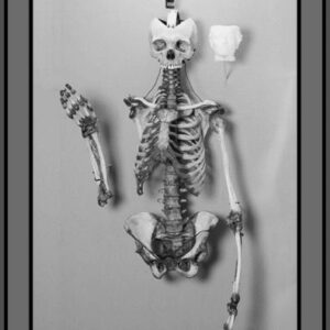Carla Valentine Instagram - This is the skeleton of ‘The Yorkshire Witch’ Mary Bateman, 1768- 1809, and an image of a cup made from her skin. (Straight off the bat I want to give @thepoisonerscabinet a shoutout because I learned about this woman in Ep 14 of their podcast and they recently reached over 200!)
☠️
Although Mary was known as ‘The Yorkshire Witch’ she was actually a con artist and murderer of 5 people. There’s so much to tell about her crimes but my favourite has to be when she claimed she had a chicken who could predict the Apocalypse. It was known as “The Prophet Hen of Leeds” and it laid eggs which said CRIST IS COMING (she misspelled ‘Christ’, and I think it would have been even funnier if she’d written ‘Chris’!)
☠️
Mary very cleverly etched this phrase into the shells of the eggs with vinegar - rather than writing it on with ink - because it looked more organic; like a part of the surface. This is because the acetic acid in the vinegar neutralises the calcium carbonate in the shell of the egg, releasing carbon dioxide, causing it to lighten in colour and become thinner. The second part of this con, apparently re-inserting the inscribed eggs into the unfortunate hen, is a bit harder to verify…
☠️
After eventually being exposed as a fraud and murderer she was hanged in York Castle and, as was the custom at the time, “anatomised” or dissected publicly. Her skeleton was then displayed to anyone who paid and her skin was flayed and tanned. It was used to bind books, which are no longer in existence, and used to make a folding cup, which I have to say I’ve never really come across before.
☠️
Up until 2015 most of her skeleton, pictured, was on public display at the Thakray Museum in Leeds. However, with changing attitudes towards the display of human remains and the subsequent Human Tissue Act coming into force, she has been in private storage in the anatomy department of Leeds Medical School since then
(Lots of this info is from MURDERERS' LEATHER By EDWARD ELMHIRST 1954)
☠️
#skeleton #humanremains #witch #poisoner