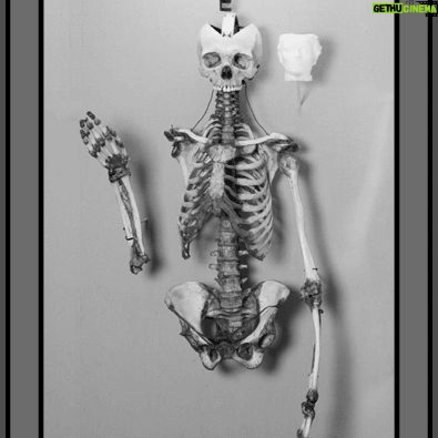Carla Valentine - 561 Likes - This is the skeleton of ‘The Yorkshire Witch’ Mary Bateman, 1768- 1809, and an image of a cup made from her skin. (Straight off the bat I want to give @thepoisonerscabinet a shoutout because I learned about this woman in Ep 14 of their podcast and they recently reached over 200!)
☠️
Although Mary was known as ‘The Yorkshire Witch’ she was actually a con artist and murderer of 5 people. There’s so much to tell about her crimes but my favourite has to be when she claimed she had a chicken who could predict the Apocalypse. It was known as “The Prophet Hen of Leeds” and it laid eggs which said CRIST IS COMING (she misspelled ‘Christ’, and I think it would have been even funnier if she’d written ‘Chris’!)
☠️
Mary very cleverly etched this phrase into the shells of the eggs with vinegar - rather than writing it on with ink - because it looked more organic; like a part of the surface. This is because the acetic acid in the vinegar neutralises the calcium carbonate in the shell of the egg, releasing carbon dioxide, causing it to lighten in colour and become thinner. The second part of this con, apparently re-inserting the inscribed eggs into the unfortunate hen, is a bit harder to verify…
☠️
After eventually being exposed as a fraud and murderer she was hanged in York Castle and, as was the custom at the time, “anatomised” or dissected publicly. Her skeleton was then displayed to anyone who paid and her skin was flayed and tanned. It was used to bind books, which are no longer in existence, and used to make a folding cup, which I have to say I’ve never really come across before.
☠️
Up until 2015 most of her skeleton, pictured, was on public display at the Thakray Museum in Leeds. However, with changing attitudes towards the display of human remains and the subsequent Human Tissue Act coming into force, she has been in private storage in the anatomy department of Leeds Medical School since then
(Lots of this info is from MURDERERS' LEATHER By EDWARD ELMHIRST 1954)
☠️
#skeleton #humanremains #witch #poisoner