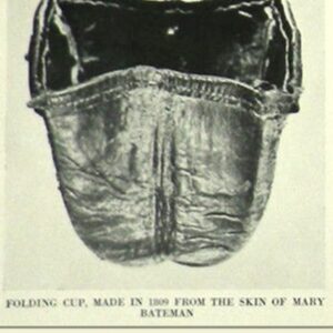 Carla Valentine Instagram - This is the skeleton of ‘The Yorkshire Witch’ Mary Bateman, 1768- 1809, and an image of a cup made from her skin. (Straight off the bat I want to give @thepoisonerscabinet a shoutout because I learned about this woman in Ep 14 of their podcast and they recently reached over 200!)
☠️
Although Mary was known as ‘The Yorkshire Witch’ she was actually a con artist and murderer of 5 people. There’s so much to tell about her crimes but my favourite has to be when she claimed she had a chicken who could predict the Apocalypse. It was known as “The Prophet Hen of Leeds” and it laid eggs which said CRIST IS COMING (she misspelled ‘Christ’, and I think it would have been even funnier if she’d written ‘Chris’!)
☠️
Mary very cleverly etched this phrase into the shells of the eggs with vinegar - rather than writing it on with ink - because it looked more organic; like a part of the surface. This is because the acetic acid in the vinegar neutralises the calcium carbonate in the shell of the egg, releasing carbon dioxide, causing it to lighten in colour and become thinner. The second part of this con, apparently re-inserting the inscribed eggs into the unfortunate hen, is a bit harder to verify…
☠️
After eventually being exposed as a fraud and murderer she was hanged in York Castle and, as was the custom at the time, “anatomised” or dissected publicly. Her skeleton was then displayed to anyone who paid and her skin was flayed and tanned. It was used to bind books, which are no longer in existence, and used to make a folding cup, which I have to say I’ve never really come across before.
☠️
Up until 2015 most of her skeleton, pictured, was on public display at the Thakray Museum in Leeds. However, with changing attitudes towards the display of human remains and the subsequent Human Tissue Act coming into force, she has been in private storage in the anatomy department of Leeds Medical School since then
(Lots of this info is from MURDERERS' LEATHER By EDWARD ELMHIRST 1954)
☠️
#skeleton #humanremains #witch #poisoner