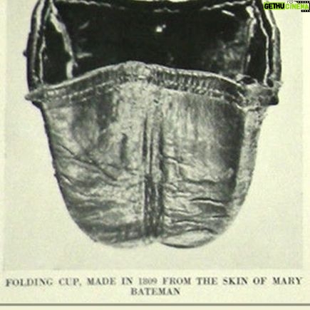 Carla Valentine - 561 Likes - This is the skeleton of ‘The Yorkshire Witch’ Mary Bateman, 1768- 1809, and an image of a cup made from her skin. (Straight off the bat I want to give @thepoisonerscabinet a shoutout because I learned about this woman in Ep 14 of their podcast and they recently reached over 200!)
☠️
Although Mary was known as ‘The Yorkshire Witch’ she was actually a con artist and murderer of 5 people. There’s so much to tell about her crimes but my favourite has to be when she claimed she had a chicken who could predict the Apocalypse. It was known as “The Prophet Hen of Leeds” and it laid eggs which said CRIST IS COMING (she misspelled ‘Christ’, and I think it would have been even funnier if she’d written ‘Chris’!)
☠️
Mary very cleverly etched this phrase into the shells of the eggs with vinegar - rather than writing it on with ink - because it looked more organic; like a part of the surface. This is because the acetic acid in the vinegar neutralises the calcium carbonate in the shell of the egg, releasing carbon dioxide, causing it to lighten in colour and become thinner. The second part of this con, apparently re-inserting the inscribed eggs into the unfortunate hen, is a bit harder to verify…
☠️
After eventually being exposed as a fraud and murderer she was hanged in York Castle and, as was the custom at the time, “anatomised” or dissected publicly. Her skeleton was then displayed to anyone who paid and her skin was flayed and tanned. It was used to bind books, which are no longer in existence, and used to make a folding cup, which I have to say I’ve never really come across before.
☠️
Up until 2015 most of her skeleton, pictured, was on public display at the Thakray Museum in Leeds. However, with changing attitudes towards the display of human remains and the subsequent Human Tissue Act coming into force, she has been in private storage in the anatomy department of Leeds Medical School since then
(Lots of this info is from MURDERERS' LEATHER By EDWARD ELMHIRST 1954)
☠️
#skeleton #humanremains #witch #poisoner
