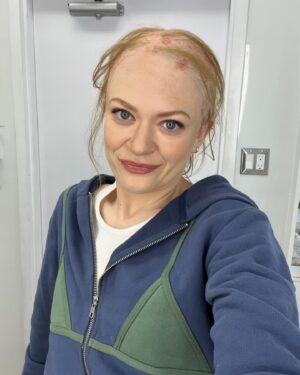 Colby Minifie Instagram - 🚨Spoilers!!!🚨what fun what fun it was to shoot this final episode of season 4, directed by @erickripke1. I screamed so hard when shooting up V I burst all the blood vessels under my eyes. And some track marks to prove it. The final pic is a mishap with the printer in the makeup trailer that produced my favorite pic of me of all time. Thanks Amber!! And a big thanks to @zeelowcee for this epic prosthetic ❤️❤️ big love to the whole crew