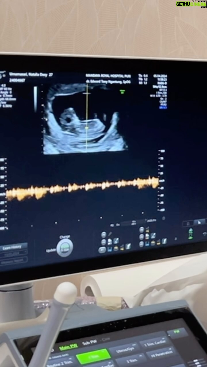 Desy Genoveva - 12.8K Likes - Detak jantung yang membuatku mrebes mili terharu 🥹🥹
Sehat2 dan terus berkembang ya naak 🤗🤗🤗😇😇
Amiiin 😇🙏 #pregnancyjourney