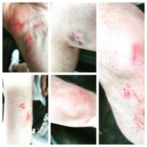 Drew Carey Instagram - Battle scars from #CrystalCave #Belize Gonna wear long pants/sleeves next time