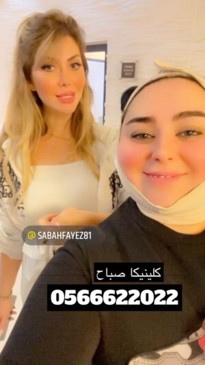 Dumoo Tahseen Instagram - @clinicasabah @sabah_alashkar اجيت اسوي استشاره عند دكتوره صباح كلينيكا وخلتني اسوي العملية بنفس اللحظة بدون اي الم والنتيجة خيالية شكرا من كل قلبي وراح اشوفكم الصوره قبل وبعد