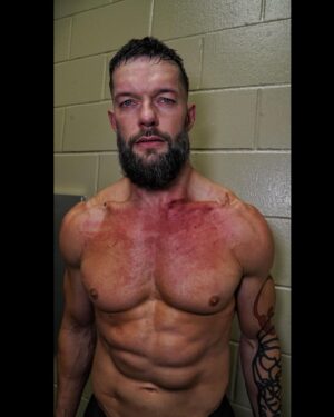 Fergal Devitt Instagram - 
