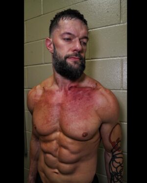 Fergal Devitt Instagram - 